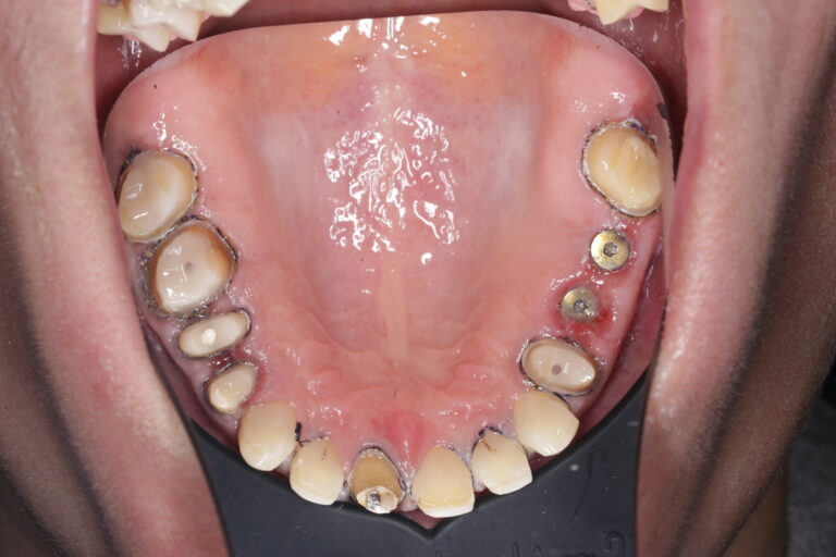 До
